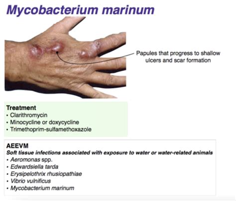 Infectious Disease Flashcards Quizlet