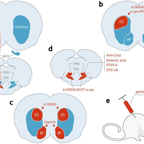 Overview Of Commonly Used Lesion Models To Induce Locomotor And Gait