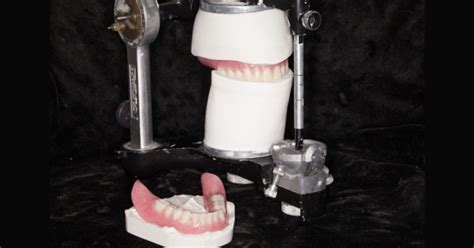 Clinical Remount Procedure A Visual Guide Spear Education