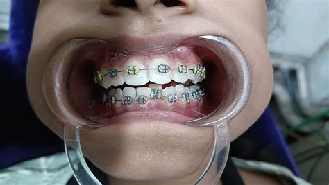 family dental art fzamili dental art badda