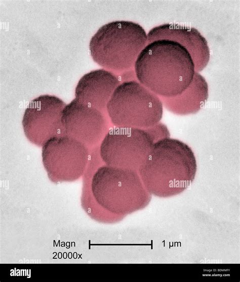 Scanning Electron Micrograph Sem Of Clusters Of Gram Positive Beta Hemolytic Group C