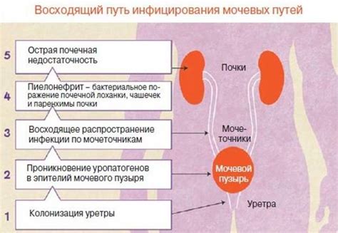 Инфекции мочевыводящих путей у детей: лечение, выписанные препараты ...