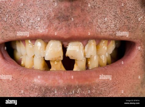 Bad for teeth hi-res stock photography and images - Alamy