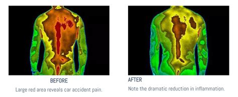 F Scan Light Therapy The Wellness Centre Of Baton Rouge