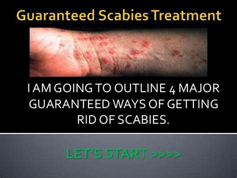 Guaranteed Scabies Treatment