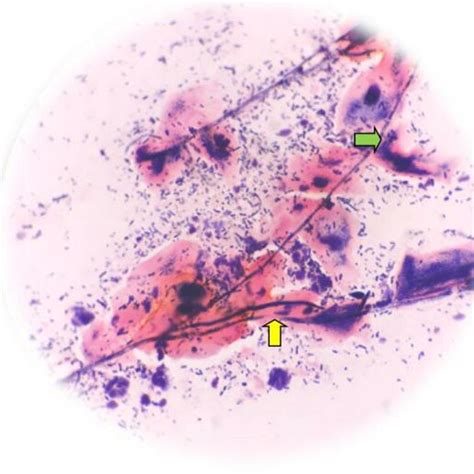 Yeast Cell And Pseudohyphae Of Candida Spp Appearance On Download Scientific Diagram