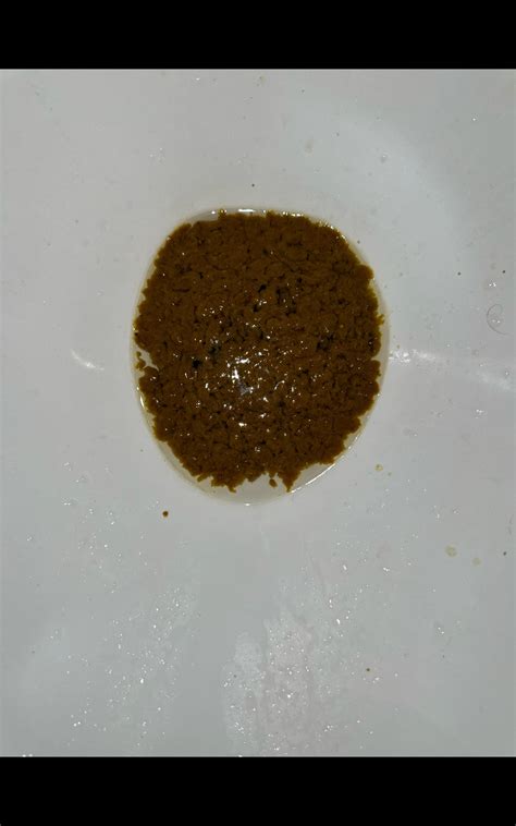 is this pencil thin stools : r/poop