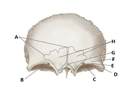 Frontal bone - landmarks Flashcards | Quizlet