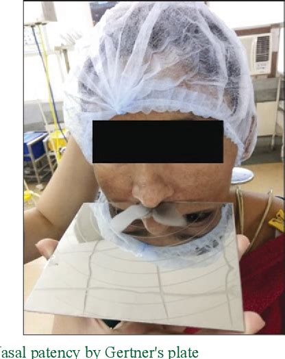 Figure From Evaluating Surgical Outcomes Of Conventional Versus