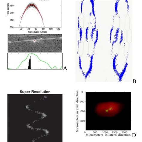 Pdf Ultrasound Localization Microscopy And Super Resolution A State