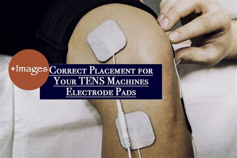 Correct Placement For Your Tens Machines Electrode Pads With Images