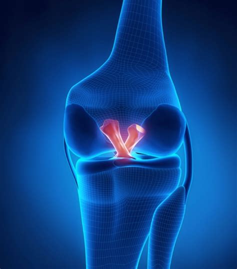 La Traumatolgia Sportiva Del Ginocchio Meniscale E Legamentosa