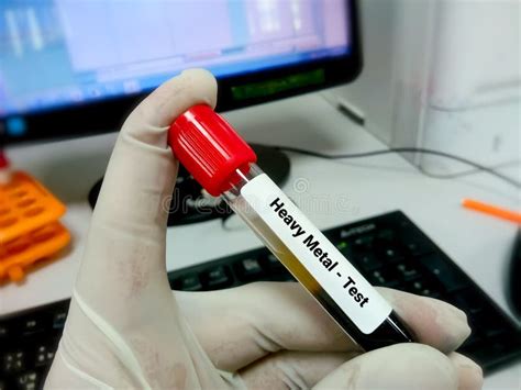 Heavy Metal Test Blood Toxicity Test Stock Photo Image Of Patient