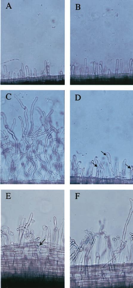 Nod Factor Induced Root Hair Deformation Is Reduced In Nsp2 Mutants