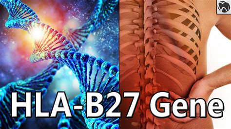 Ankylosing Spondylitis CAUSES | HLA-B27 Gene Factor | Spinal Arthritis ... 