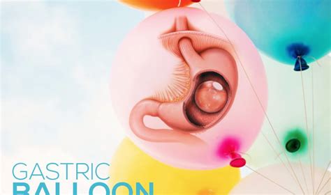 Balloon Gastric Procedure and All about it | Healing Clinic Turkey