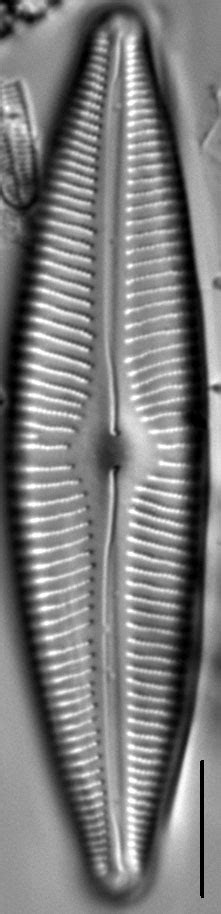 Image Cymbosublance Species Diatoms Of North America