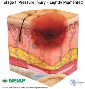 Unit Complications Of Altered Mobility Visual Disorders Hearing