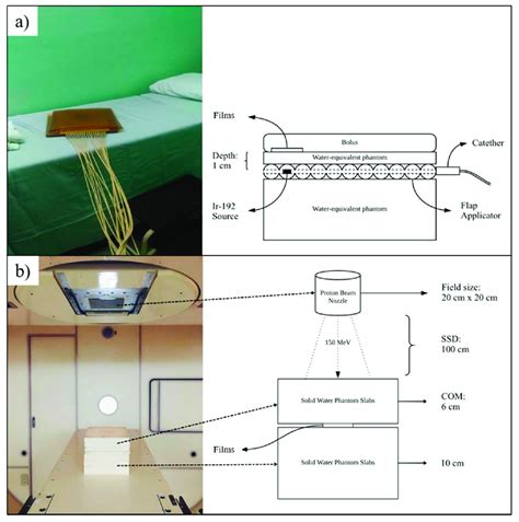 The Irradiation Setup And Schematic Diagram For A Hdr Brachytherapy