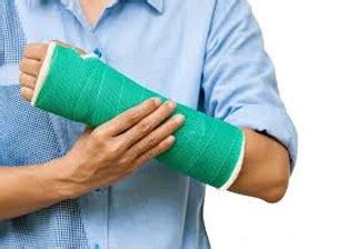 What is a comminuted fracture? 