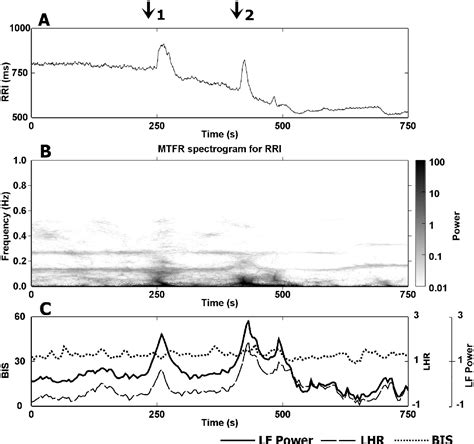 Figure 6 4 From The Modeling And Quantification Of Rhythmic To Non