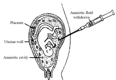 Neet Aiims Biology Reproductive Health