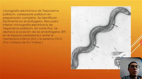 Espiroquetas (Bacteriología Medicinal) - YouTube