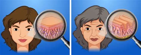 Signs Symptoms Of Collagen Deficiency