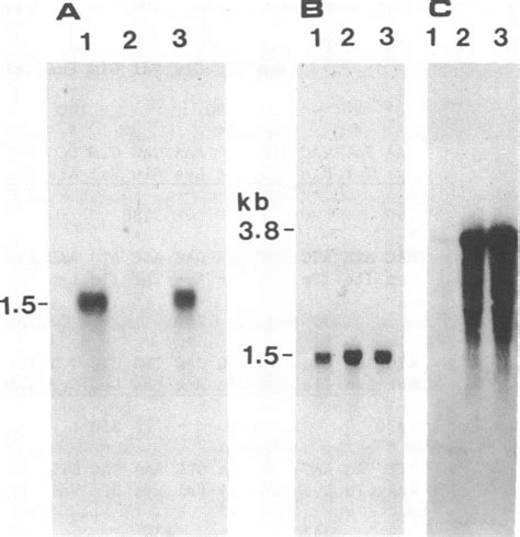 A Total Rna 10 Jg From The Liver Of A Normal Rat Lane 1 Human