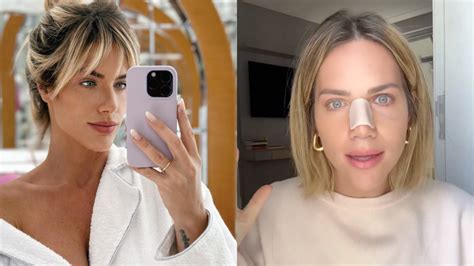 Giovanna Ewbank Compartilha Detalhes De Cirurgia No Nariz