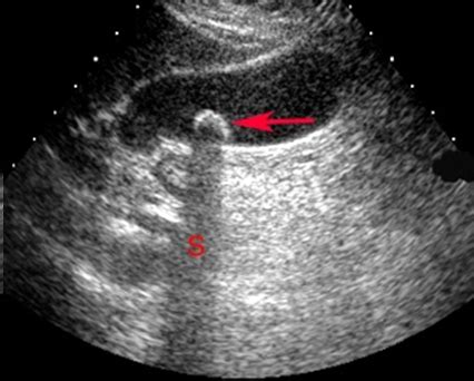 Clin Lab Ultrasounds Flashcards Quizlet