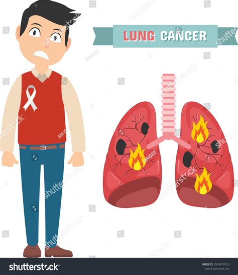 Infographic Man Lung Cancer Concept Symptoms Stock Vector (Royalty Free) 1519470155 | Shutterstock