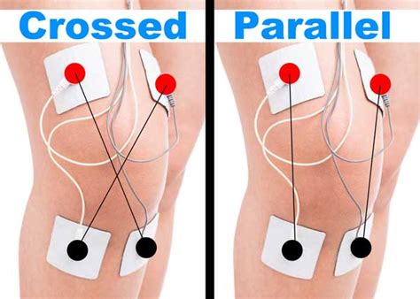 BEST Tens Placement for Knee Pain