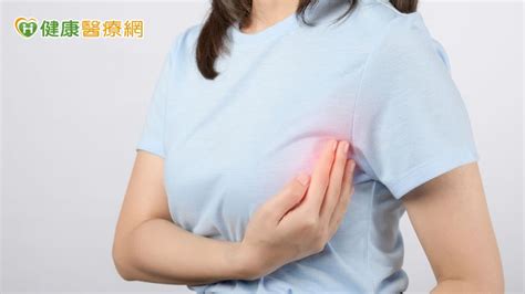 熟女健檢意外發現乳腺管原位癌 乳房全切術後「自體乳房重建」增信心