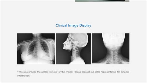 Mobilecooper Mobile Radiography System Mobile X Ray