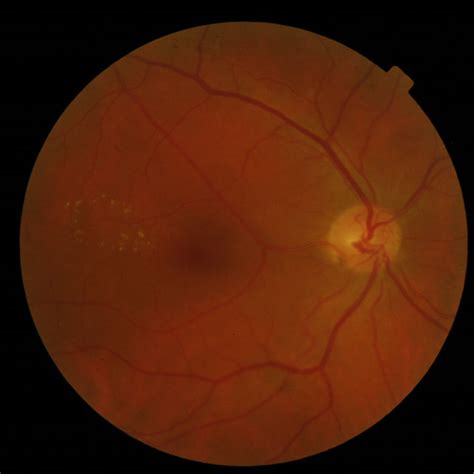 sample image   ophtha    output  enhancement