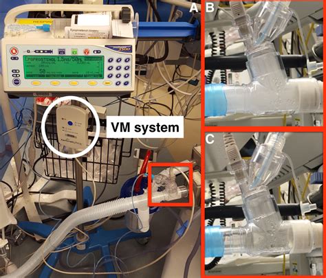 Intrapulmonary Milrinone For Cardiac Surgery Provides Insight Into