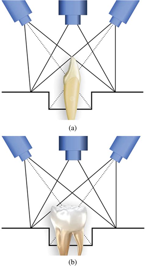 Confocal D Optical Intraoral Scanners And Comparison Of Image