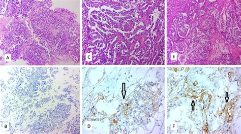 Microscopic Examination Of Hematoxylin And Eosin And Ihc Stained Download Scientific Diagram