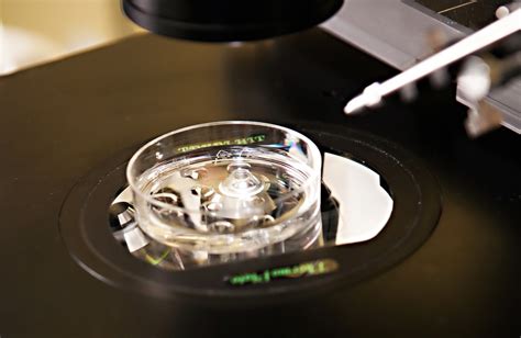 In Vitro Fertilization (IVF): Side Effects and Risks