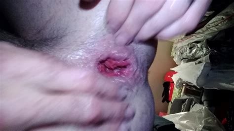 Gaping Man Boy Pussy Anal Gape Butt Hole Rose Bud Xhamster