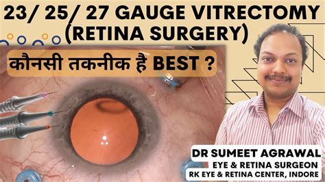 23 25 27 Gauge Retina Surgery Vitrectomy Which Technique Is The