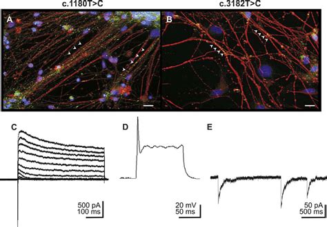 Examination Of Neural Progenitor Cells Derived Neurons Neural Download Scientific Diagram