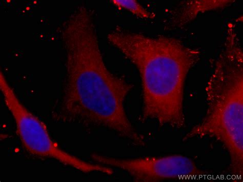 PHGDH Fusion Protein Ag6445 Proteintech 武汉三鹰生物技术有限公司