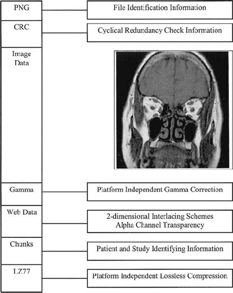 Schematic illustrates PNG attributes. | Download Scientific Diagram 
