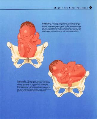 Smyrna Baby: Transverse Lie Position: A Visual