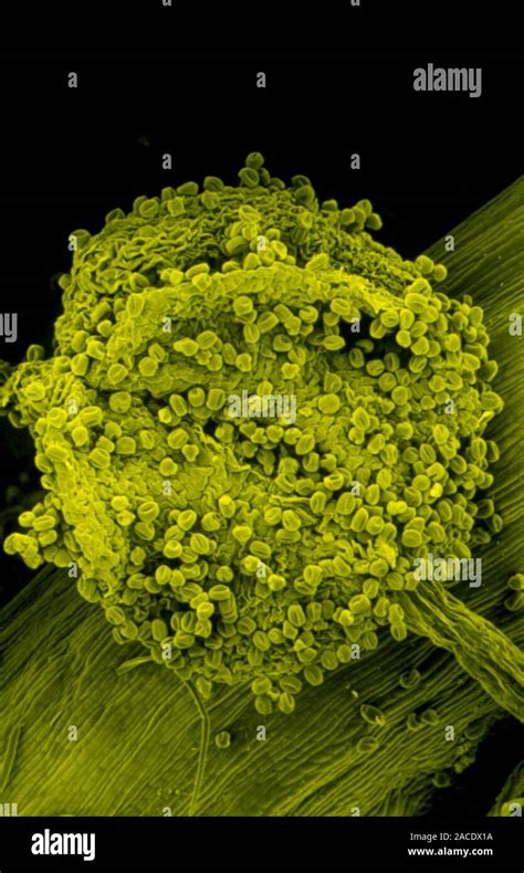 False Colour Scanning Electron Micrograph Sem Of Pollen Grains Around