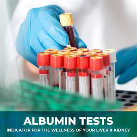 ALBUMIN TEST – INDICATOR FOR THE WELLNESS OF YOUR LIVER & KIDNEY… – PT ...