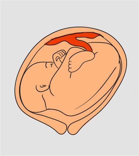 5 Ways To Turn A Baby From Transverse Lie Position