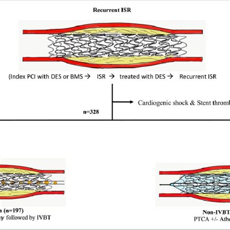 Pdf Intravascular Brachytherapy For The Management Of Repeated